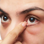 Ophthalmology | Dry Eye Treatment | Morristown