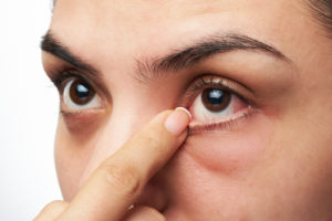 Ophthalmology | Dry Eye Treatment | Morristown 