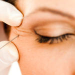 Dermal Fillers Chester, NJ