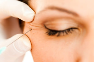 Dermal Fillers Chester, NJ